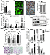 Prdm16 is required for expression of a thermogenic gene program in subcutan