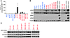 Preferential activation of the IL-6/JAK2/Stat3 pathway in basal-like breast