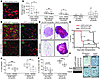 Importance of the IL-6/JAK2/Stat3 pathway in tumor growth.