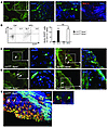 CCL17-expressing DCs accumulate within atherosclerotic lesions.