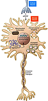 Multiple pathogenic mechanisms of mutant huntingtin include loss of BDNF ne