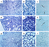 The effect of hFas-Fc on the microscopic findings of the murine lungs after