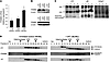 Defective immunoproteasome complexes in JASL cells.