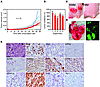 KMM cells induce tumors in nude mice.