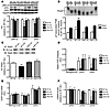 CR reduces the expression of the p55α/p50α regulatory subunits of PI3K and