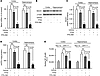 Effects of FPS-ZM1 and FPS2 on BACE1 in brains of 17-month-old APPsw/0 mice