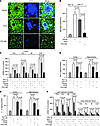 FPS-ZM1 and FPS2 control the neuroinflammatory response in 17-month-old APP