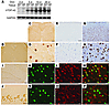 Restricted overexpression of mutant human TDP-43 (hTDP-43) in neurons is ac