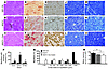 Motor units are remodeled in diseased rats after mutant TDP-43 is removed.