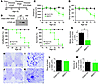 Restricted overexpression of mutant TDP-43 in motor neurons results in prog