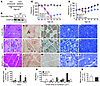 Suppressing mutant TDP-43 expression prevents disease from progression in r