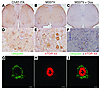 Ubiquitin accumulates in the motor neurons of ALS rats.