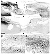 SHEDs regenerate CST fibers.