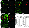 SHEDs suppress the apoptosis of neural cell lineages and secondary injury a