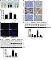 Renal Hb exposure, metabolic activation, and oxidative stress.