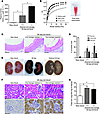 Cardiorenal response to 28-day-old blood transfusion before and after washi