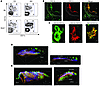 Myeloid cells in aortic plaque and adventitia.