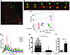 2-photon imaging of T cell–APC interaction in aortic wall.