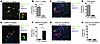 2-photon imaging of antigen-specific T cell–APC interaction in aortic wall.