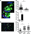 2-photon imaging of Apoe–/– CD4+ T cell–APC interaction in the plaque and a