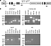 5′RACE and RT-PCR analysis of aberrantly spliced transcripts in clones of J