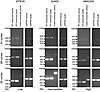 Semiquantitative PCR analysis of wild-type and aberrantly spliced transcrip