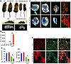 Analysis of the more severe dystrophic phenotype of miR-206–KO;mdx mice.