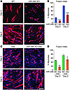 miR-206 regulates SC differentiation.