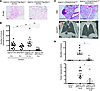 NKX2-1 inhibits urethane- and KrasG12D-induced lung tumor formation in vivo