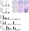 EGFRL858R mice did not develop mucinous adenocarcinoma of the lung regardle