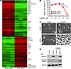 NKX2-1 inhibited mRNAs associated with tumorigenesis and induced those rela