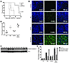 Btz and SAHA combination prolongs survival of PEL-bearing mice by inducing