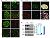 Nuclear NKX6.1 levels are profoundly reduced in diabetic db/db islet β cell