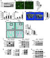 Mice with OC-specific deletion of TRAF3 have increased osteoclastogenesis a