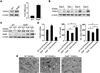 RelB positively regulates RANKL-induced TRAF3 degradation.