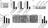 RANKL-induced TRAF3 degradation is absent in BECN1, but not in ATG5/7 knock