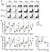 Distinct effects of IL-2 therapy and PD-L1 blockade on antiviral CD8 T cell