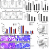 S100A9Tg mice have increased accumulation and activation of MDSC and displa