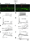 Activation of low-threshold Aβ fibers evokes AP output of the nociceptive p