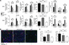 Alloreactive T cell responses are diminished in the absence of B cells.