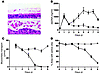 Ciliated cell shedding and loss of cilia activity during RSV-GFP infection