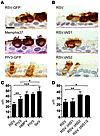 RSV-induced ciliated cell rounding is unique to RSV infection and is due to