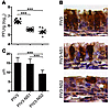 PIV3-NS2 causes ciliated cell rounding in the hamster nasal respiratory epi