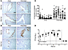 Distal airway obstruction and accelerated clearance of virus infection in h