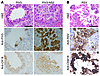 Shed epithelial cells infected by PIV3-NS2 into hamster lower conducting ai