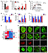 miR-7a levels correlate with β cell secretory function in insulin resistant