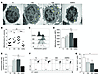 EMRA CD8+ T cells display mitochondrial impairment after stimu