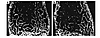 Undecalcified sections of the distal femur of (a) an 8-month-old Fgf2+/+ mo