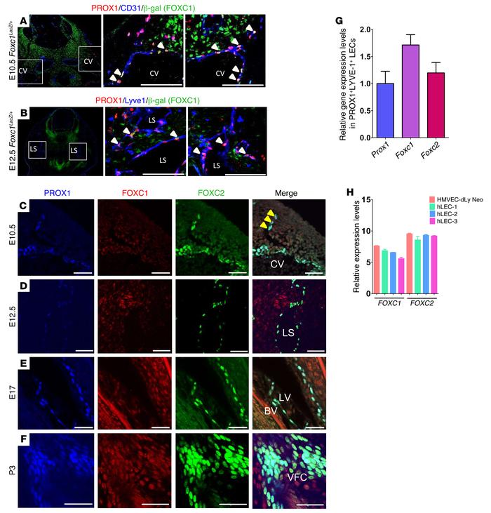 FOXC1 and FOXC2 are coexpressed in LEC progenitors and lymphatic valve-f...