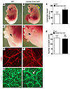 Global deletion of Foxc1 results in lymphatic vessel abnormalities.